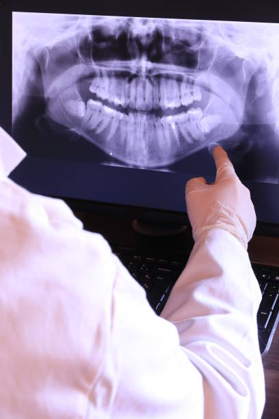 Best Emergency Tooth Extraction in Long Beach, MD