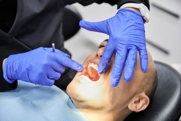 Best Emergency Denture Repair in Long Beach, MD