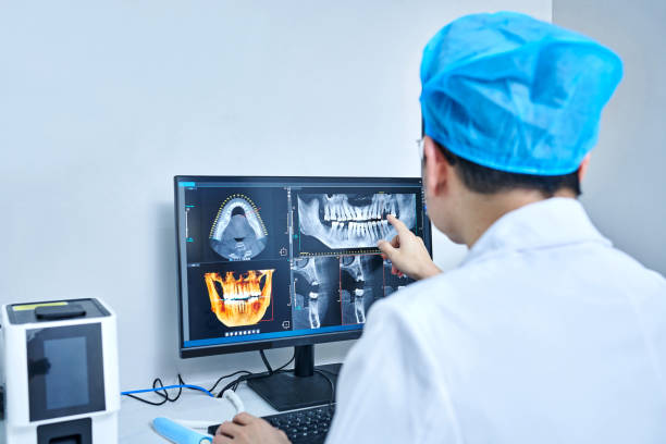 Best Emergency Dental Care for Broken or Chipped Teeth in Long Beach, MD