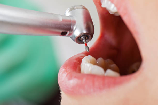 Best Cosmetic Emergency Dentistry in Long Beach, MD
